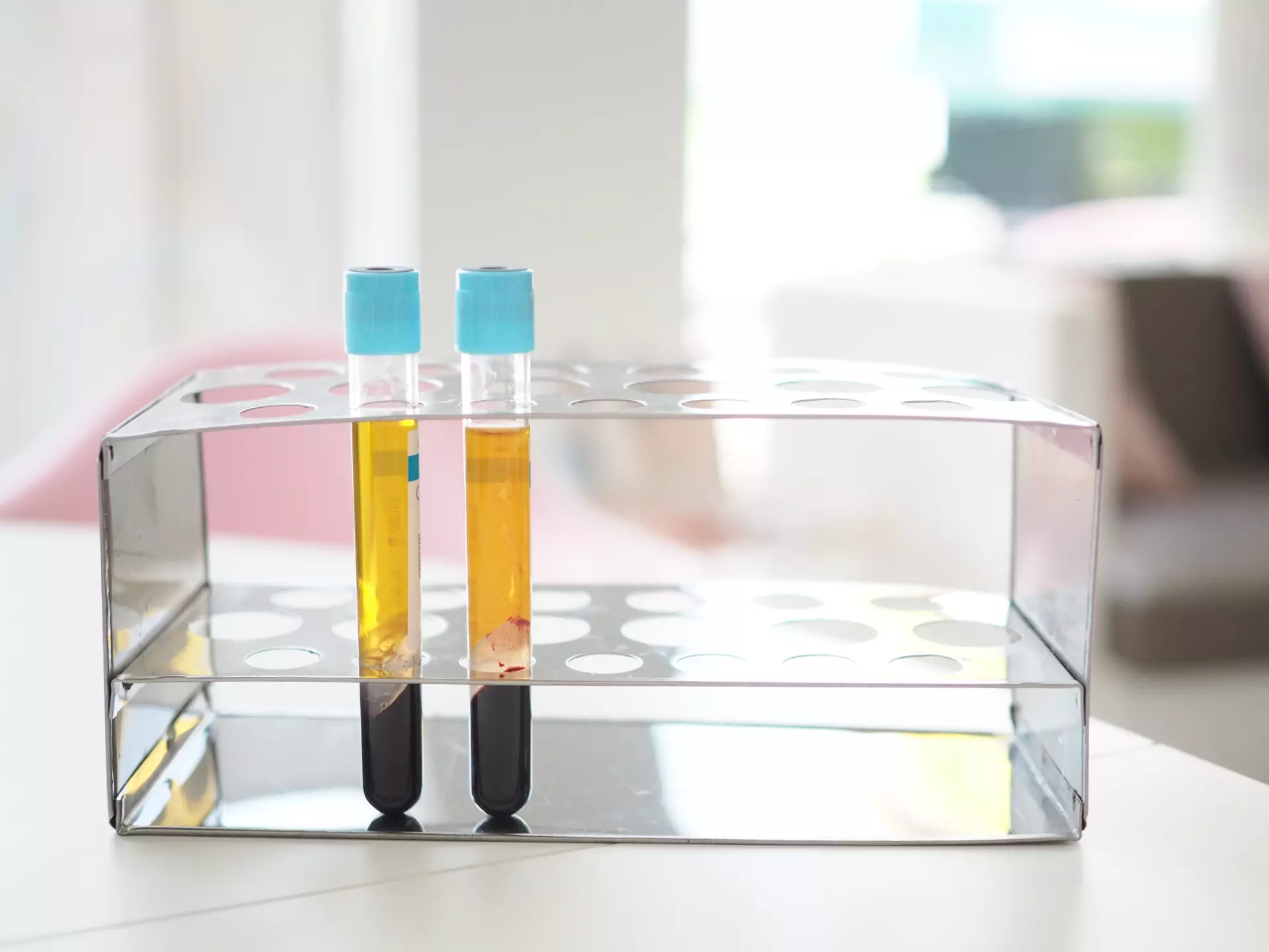 platelet rich plasma PRP therapy at Performance Foot & Ankle in Thousand Oaks, CA