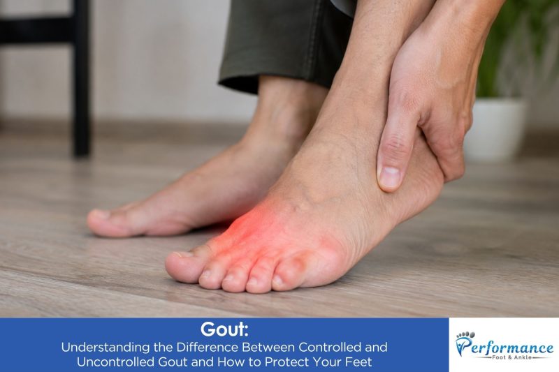Gout: Understanding the Difference Between Controlled and Uncontrolled Gout and How to Protect Your Feet
